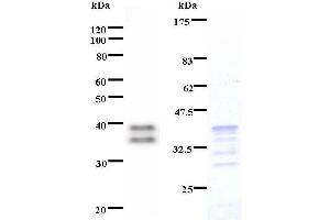 Left: HIVEP2 staining.