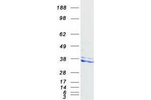 Validation with Western Blot