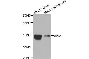 Western blot analysis of extracts of various cell lines, using GNAO1 antibody. (GNAO1 anticorps  (AA 60-180))