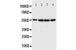 Western Blotting (WB) image for anti-Fascin (FSCN1) (AA 97-113), (N-Term) antibody (ABIN3044444) (Fascin anticorps  (N-Term))