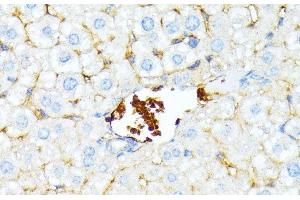 Immunohistochemistry of paraffin-embedded Mouse liver using SPTA1 Polyclonal Antibody at dilution of 1:100 (40x lens). (SPTA1 anticorps)