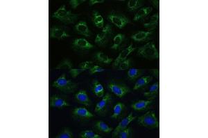 Immunofluorescence analysis of U-2 OS cells using P Polyclonal Antibody (ABIN7269446) at dilution of 1:100 (40x lens).