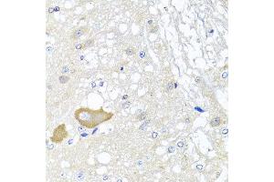 Immunohistochemistry of paraffin-embedded rat brain using MCCC2 antibody at dilution of 1:100 (x40 lens). (MCCC2 anticorps)
