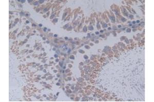 IHC-P analysis of Rat Testis Tissue, with DAB staining. (MUC20 anticorps  (AA 113-347))