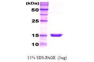 Figure annotation denotes ug of protein loaded and % gel used. (G-CSF Protéine)