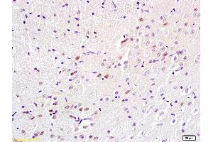 Formalin-fixed and paraffin embedded rat brain labeled with Anti-BS69/Adenovirus 5 E1A binding protein Polyclonal Antibody, Unconjugated (ABIN872692) at 1:200 followed by conjugation to the secondary antibody and DAB staining.