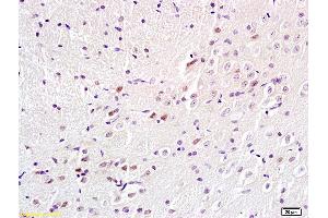 Formalin-fixed and paraffin embedded rat brain labeled with Anti-BS69/Adenovirus 5 E1A binding protein Polyclonal Antibody, Unconjugated (ABIN872692) at 1:200 followed by conjugation to the secondary antibody and DAB staining. (ZMYND11 anticorps  (AA 501-602))