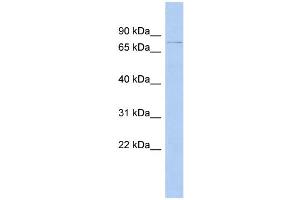 WB Suggested Anti-DHX58 Antibody Titration:  0. (DHX58 anticorps  (N-Term))