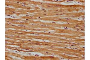 IHC image of ABIN7171044 diluted at 1:600 and staining in paraffin-embedded human heart tissue performed on a Leica BondTM system.