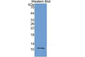 WB of Protein Standard: different control antibodies against Highly purified E. (MMP12 Kit ELISA)