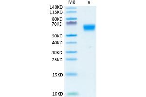 Human TGF-beta RII on Tris-Bis PAGE under reduced condition.