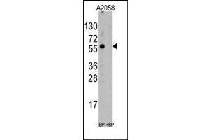 Image no. 1 for anti-Suppression of Tumorigenicity 13 (ST13) (N-Term) antibody (ABIN358737) (HSC70 Interacting Protein HIP anticorps  (N-Term))
