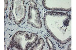 Image no. 7 for anti-Zinc Finger, BED-Type Containing 1 (ZBED1) antibody (ABIN1501794)