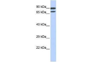 WB Suggested Anti-ZNF583 Antibody Titration:  0. (ZNF583 anticorps  (N-Term))