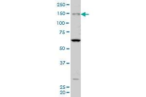 MYO3A monoclonal antibody (M08A), clone 8H2 Western Blot analysis of MYO3A expression in Hela S3 NE . (MYO3A anticorps  (AA 1400-1490))