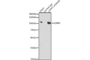 Immunoprecipitation analysis of 300 μg extracts of A-549 cells using 3 μg LONP1 antibody (ABIN1680707, ABIN3018785, ABIN3018786 and ABIN6220576).