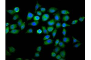 Immunofluorescence staining of Hela cells with ABIN7175695 at 1:66, counter-stained with DAPI. (WDFY2 anticorps  (AA 2-114))