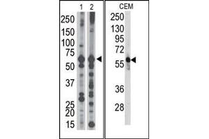 Image no. 1 for anti-6-phosphofructo-2-Kinase/fructose-2,6-Biphosphatase 3 (PFKFB3) (C-Term) antibody (ABIN360653) (PFKFB3 anticorps  (C-Term))