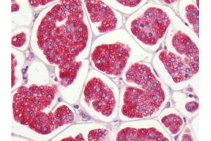 Human, Adrenal: Formalin-Fixed Paraffin-Embedded (FFPE) (P2RY1 anticorps  (C-Term))