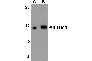 Western Blotting (WB) image for anti-Interferon-Induced Transmembrane Protein 1 (IFITM1) (Middle Region) antibody (ABIN1030951) (IFITM1 anticorps  (Middle Region))
