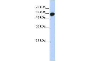 Western Blotting (WB) image for anti-Leucine Rich Repeat Containing 6 (LRRC6) antibody (ABIN2459700) (LRRC6 anticorps)