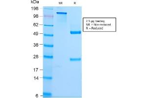 SDS-PAGE Analysis Purified Spectrin Beta 3 Rabbit Monoclonal Antibody (SPTBN2/2979R).