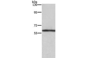 Western Blot analysis of Mouse kidney tissue using TBX5 Polyclonal Antibody at dilution of 1:350 (T-Box 5 anticorps)