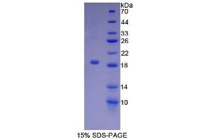SDS-PAGE (SDS) image for Biglycan (BGN) (AA 49-182) protein (His tag) (ABIN1098900)