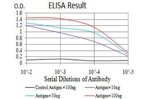 Black line: Control Antigen (100 ng),Purple line: Antigen (10 ng), Blue line: Antigen (50 ng), Red line:Antigen (100 ng)