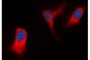 Immunofluorescent analysis of DAP Kinase 1 staining in K562 cells.