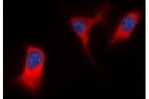 Immunofluorescent analysis of DAP Kinase 1 staining in K562 cells. (DAP Kinase 1 anticorps)