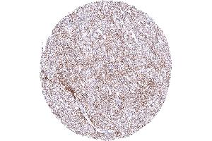 Cerebrum showing a moderate fibrillar GPM6A staining of nerve fibres (Recombinant GPM6A anticorps)