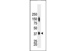 The anti-CKM Pab (ABIN391095 and ABIN2841234) is used in Western blot to detect CKM in mouse heart tissue lysate.