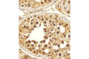 Immunohistochemical analysis of paraffin-embedded H.