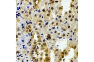 Immunohistochemical analysis of DCTD staining in rat kidney formalin fixed paraffin embedded tissue section. (DCMP Deaminase (DCTD) anticorps)