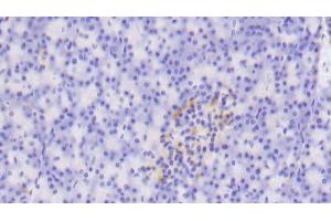 Detection of TLR5 in Human Pancreas Tissue using Polyclonal Antibody to Toll Like Receptor 5 (TLR5) (TLR5 anticorps  (AA 303-514))