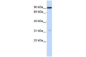 WB Suggested Anti-CHRNA4 Antibody Titration:  0. (CHRNA4 anticorps  (N-Term))