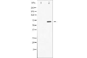 Western blot analysis of SYK phosphorylation expression in A549 whole cell lysates,The lane on the left is treated with the antigen-specific peptide.