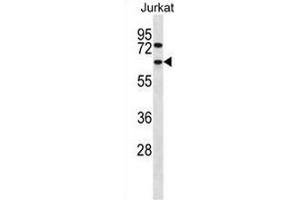 CCT4 Antibody (N-term) western blot analysis in Jurkat cell line lysates (35µg/lane). (CCT4 anticorps  (N-Term))