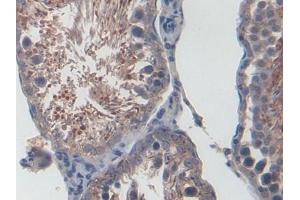 IHC-P analysis of Rat Testis Tissue, with DAB staining. (CXCL1 anticorps  (AA 25-96))