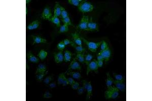 IF analysis of MAP3K8 using anti-MAP3K8 antibody (ABIN4886663). (MAP3K8 anticorps  (AA 9-193))