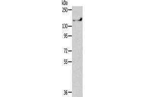 Gel: 6 % SDS-PAGE,Lysate: 40 μg,Primary antibody: ABIN7192352(SHANK1 Antibody) at dilution 1/200 dilution,Secondary antibody: Goat anti rabbit IgG at 1/8000 dilution,Exposure time: 1 minute (SHANK1 anticorps)