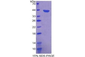 SDS-PAGE (SDS) image for Chemokine (C Motif) Ligand 1 (XCL1) (AA 23-113) protein (His tag,GST tag) (ABIN2123196)