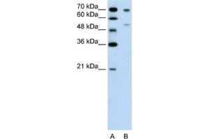 Western Blotting (WB) image for anti-Forkhead Box B2 (FOXB2) antibody (ABIN2462637) (FOXB2 anticorps)