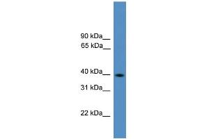 WB Suggested Anti-Pax2 Antibody Titration:  0. (PAX2A anticorps  (Middle Region))