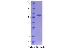 SDS-PAGE analysis of Mouse AGA Protein. (AGA Protéine)