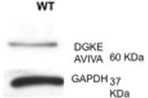 DGKE antibody - N-terminal region  validated by WB using lymph at 1:1000. (DGKE anticorps  (N-Term))