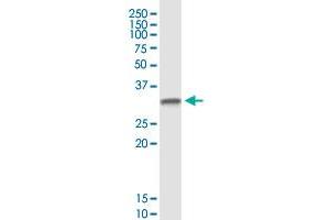 DTWD1 monoclonal antibody (M02), clone 2E6. (DTWD1 anticorps  (AA 1-304))
