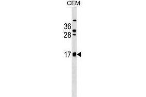 C Antibody (C-term) (ABIN1536654 and ABIN2849825) western blot analysis in CEM cell line lysates (35 μg/lane). (C2ORF83 anticorps  (C-Term))