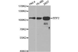 Western blot analysis of extracts of various cell lines, using EEF2 antibody (ABIN5971099) at 1/500 dilution. (EEF2 anticorps)